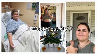 1 Week Post Op Gallbladder Surgery [upl. by Wilhelm]