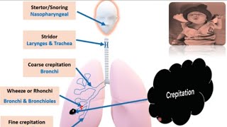 Respiratory System Examination in Newborn I Newborn Examination PART 6  Pediatrics [upl. by Annemarie456]