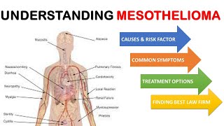 Understanding Mesothelioma Causes Symptoms and Treatment Options [upl. by Derry]