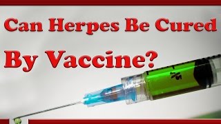 Herpes Cure News Vaccine Breakthrough 2017 [upl. by Market]