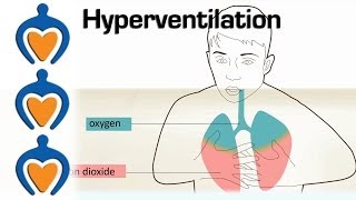 Hyperventilation  Causes and treatment of hyperventilation [upl. by Elleuqar630]