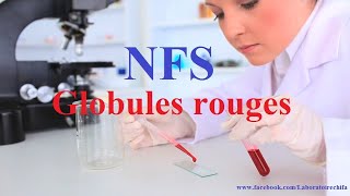 NFS Globules rouges [upl. by Indnahc]