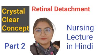 Retinal detachment notes part 2 Retinal detachment medical surgical nursing bsc nursing 3rd year [upl. by Ahsetel]