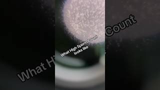 This is what high sperm count looks like  fertility infertility sperm semenhealth [upl. by Einnol]