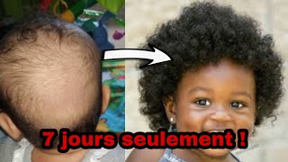 7 JOURS SEULEMENT POUR FAIRE POUSSER LES CHEVEUX DE BÉBÉ BIEN TOUFFUS [upl. by Cailly]