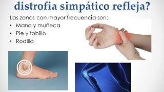 Sindrome de Sudeck  Recomendaciones de Rehabilitacion [upl. by Eetsirhc]