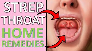 16 POWEFUL Home Remedies For Strep Throat  Causes Symptoms amp Treatment For Strep Throats [upl. by Eeb]