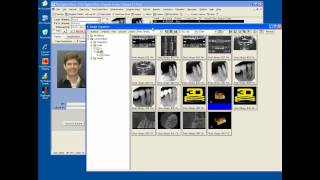 CBCT Integration to Carestream amp J Morita in TDO Software [upl. by Aihsilef539]