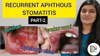 RECURRENT APHTHOUS STOMATITIS RAS PART 2 [upl. by Aihsei331]