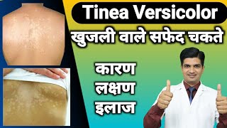 Skin की बीमारी  Tinea versicolor cause treatment [upl. by Remoh188]