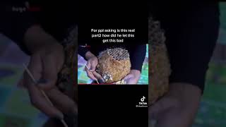 Part 2 of botfly removal from human head 🤯botfly larva removal infested [upl. by Amarillas459]