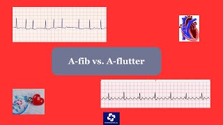 Atrial fibrillation vs Atrial Flutter [upl. by Hsuk]