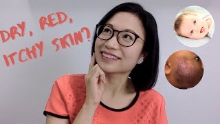 What you need to know about your babys ECZEMA or ATOPIC DERMATITIS  TIPS  Dr Kristine Kiat [upl. by Lamhaj]