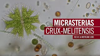 Micrasterias cruxmelitensis  by Motic Europe [upl. by Vidal]