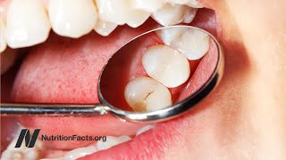 Erythritol vs Xylitol for Preventing Cavities Tooth DecayUPDATE don’t eat See doc note below [upl. by Nehte]