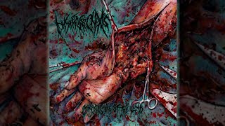 Hysterorrhexis  Maggots Infest the Limb full album [upl. by Shuler145]