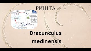 Ришта Dracunculus medinensis  Морфология Жизненный Цикл Диагностика Лечение Профилактика [upl. by Kleeman317]