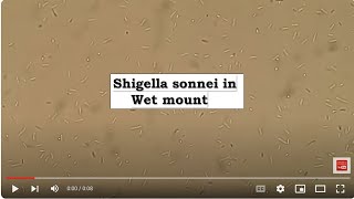 Shigella sonnei in Wet mount Microscopy [upl. by Claud]