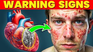 13 Skin Signs of SERIOUS Heart Problems [upl. by Eojyllib]