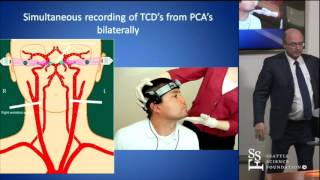 Head Turn Syncope Rotational Vertebrobasilar Ischemia by David Newell MD [upl. by Tarttan]