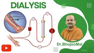 Dialysis  Hemodialysis CRRT  Class 12 Biology  by Dr Bhojoo Mal [upl. by Elletsyrk]