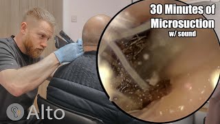 30 Minutes of MICROSUCTION Ear Wax Removal [upl. by Zinah]