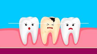 HCPCS Level II Modifiers for AmbulanceTransportation and Dental Coding [upl. by Kit]