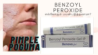 benzoyl peroxide gel review in tamil  why it is used [upl. by Elleirad918]