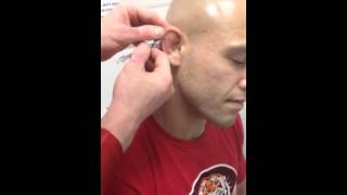 Proper treatment for Cauliflower Ear Wrestling Jiu Jitsu MMA [upl. by Ellerd]