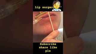 Plastic surgery youtubeshorts shortsfeed shorts ytshorts [upl. by Leiuqese995]