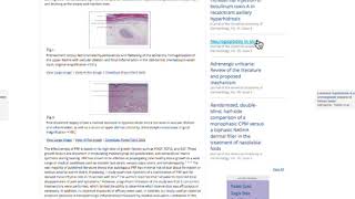 BXO lichen sclerosus in men treatment [upl. by Georgena550]