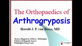 The Orthopaedics of Arthrogryposis by Dr Harold vanBosse [upl. by Ivon8]