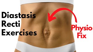 How to START Diastasis Recti Exercises that FIX YOUR GAP  PHYSIO GUIDED Abdo Separation Repair [upl. by Evelinn]