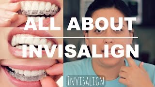 INVISALIGN REVIEW  HOW IT WORKS AND WHAT TO EXPECT [upl. by Attelrak]