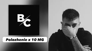 DJ Berkovic  Polozhenie x 10 MG Remix [upl. by Oiratno]