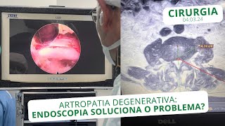 Artropatia Degenerativa Endoscopia soluciona o problema  040324 [upl. by Latrina]