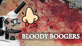 BLOODY BOOGER UNDER MICROSCOPE  100X 250X 4K [upl. by Entsirhc]