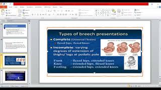 7B Malpositions amp Malpresentation part2  OBG [upl. by Marlowe603]