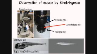 FSHD Connect 2014 Louis Kunkel Modeling FSHD in Zebrafish for Therapy Development [upl. by Eiralam373]