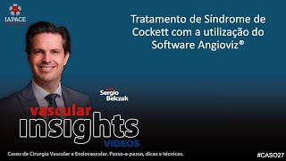 Caso 27 Tratamento de Síndrome de Cockett com a utilização do Software Angioviz [upl. by Ulphiah]