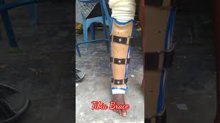 Tibia Brace [upl. by Teodor]