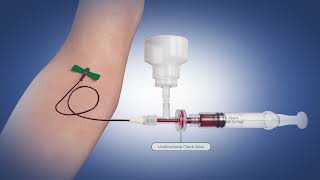 The Sequestration Syringe Blood Culture Collection Device from CQuest Medical [upl. by Annodahs]