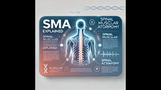 Spinal Muscular Atrophy Causes Types and Treatments Explained [upl. by Nahtnamas583]