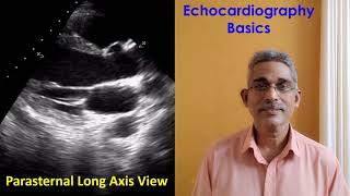 Echocardiography Basics [upl. by Ateuqal]