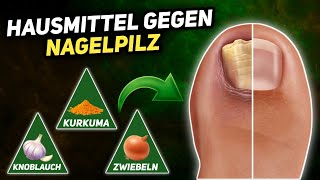 10 Natürliche Hausmittel gegen Nagelpilz Onychomykose [upl. by Amis]