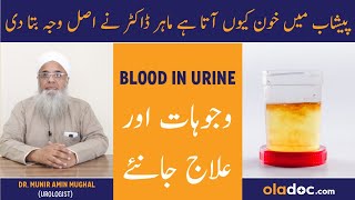 Blood in Urine Male Urdu Hindi  Peshab Men Khoon Aane Ki Wajah  Hematuria Symptoms Treatment [upl. by Neroled704]