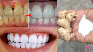 natural ways to whiten your teeth in 5 minutes with ginger and salt [upl. by Hamid]