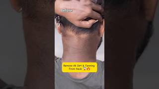 Neck Back amp Body Tan Dark Spots Removing Easy HomeRemedy tip diy shortstrending youtubeshorts [upl. by Azil]