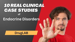 Endocrine Disorders 10 Real Clinical Case Studies  DrugLab [upl. by Orteip]