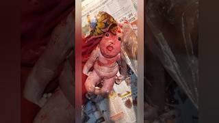 Miracle Baby anencephaly baby Without Most of His Brain Defying Odds  shorts viral trending [upl. by Milan309]